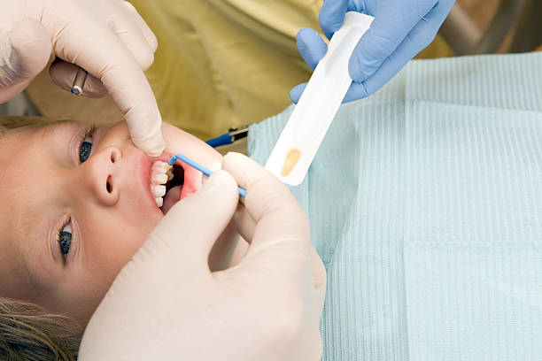menino criança receber tratamento de fluoreto de dentista - dentist dental hygiene dental assistant dentist office imagens e fotografias de stock