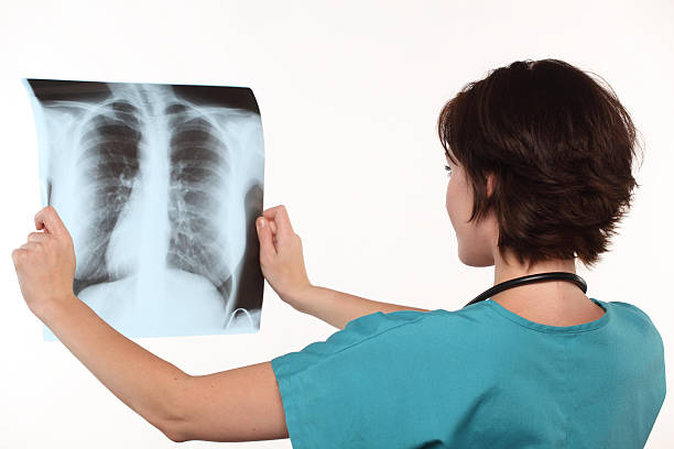 femmina medico con raggi x di polmoni - rib cage people x ray image x ray foto e immagini stock