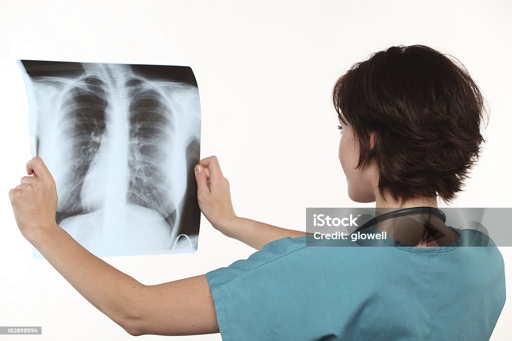 여성 담담의-폐 X-선 - 로열티 프리 결핵균 스톡 사진