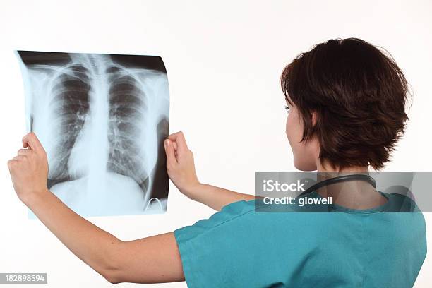 여성 담담의폐 X선 결핵균에 대한 스톡 사진 및 기타 이미지 - 결핵균, 의사, X-레이 장비