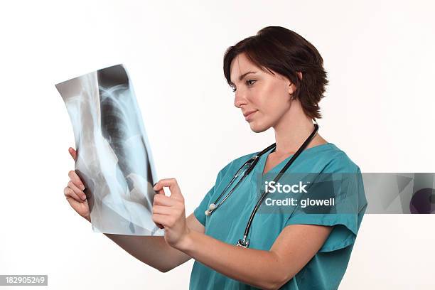 Lekarz Patrząc Na Zdjęcie Rentgenowskie Płuc - zdjęcia stockowe i więcej obrazów Aparat RTG - Aparat RTG, Badanie lekarskie, Rak płuca