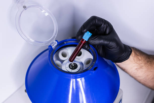 close up of the hands of a doctor putting a test tube with blood in a centrifuge to separate plasma from blood. prp therapy for rejuvenation. platelet rich plasma. - blood sample imagens e fotografias de stock