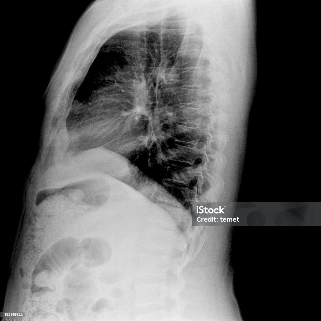 Brust (Thorax - Lizenzfrei Anatomie Stock-Foto