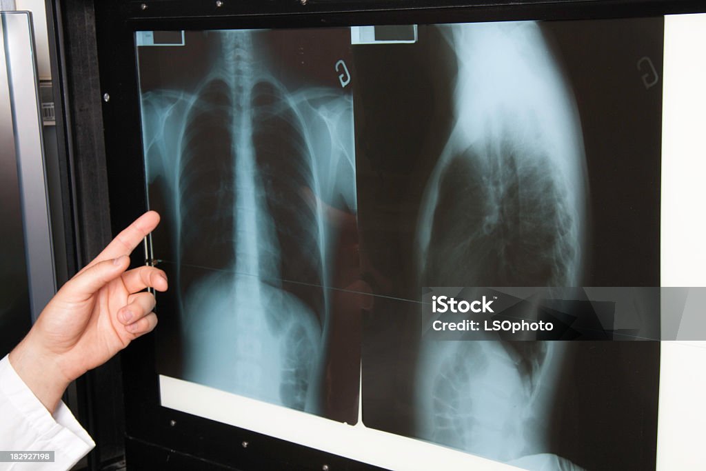 X-ray dedo Check - Foto de stock de Ala - Hospital royalty-free