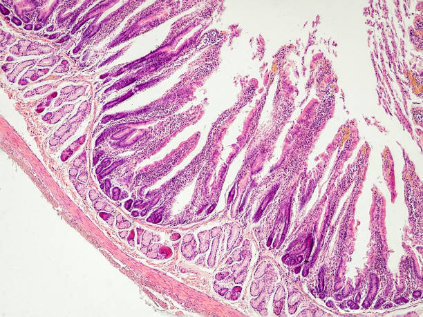 istock rabbit small intestine cross section under the microscope showing longitudinal muscle, circular muscle, submucosa, mucosa, intestinal villi and lumen - optical microscope x100 magnification 1830196505
