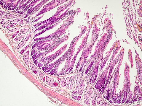 rabbit small intestine cross section under the microscope showing longitudinal muscle, circular muscle, submucosa, mucosa, intestinal villi and lumen - optical microscope x100 magnification