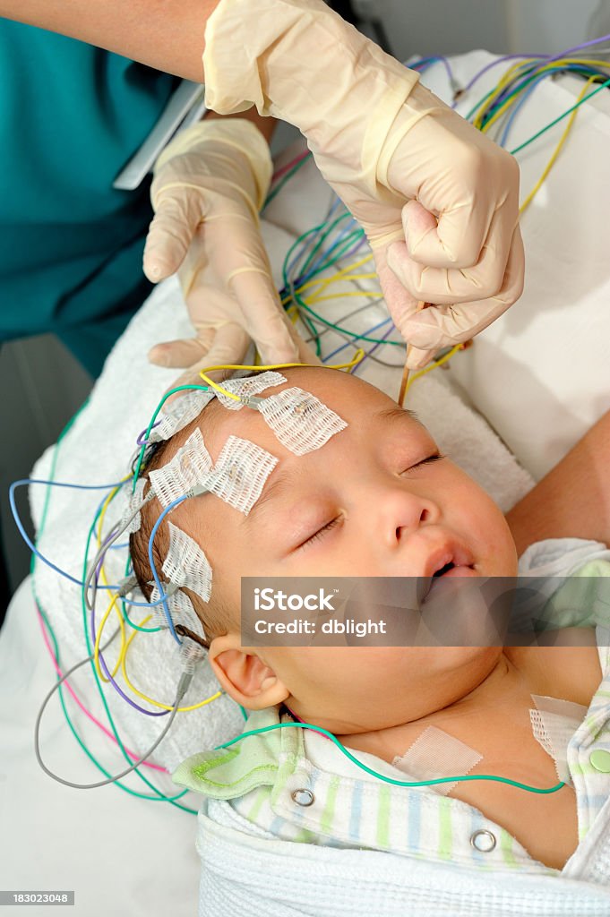 electroencephalography Électroencéphalogramme - Photo de Bébé libre de droits