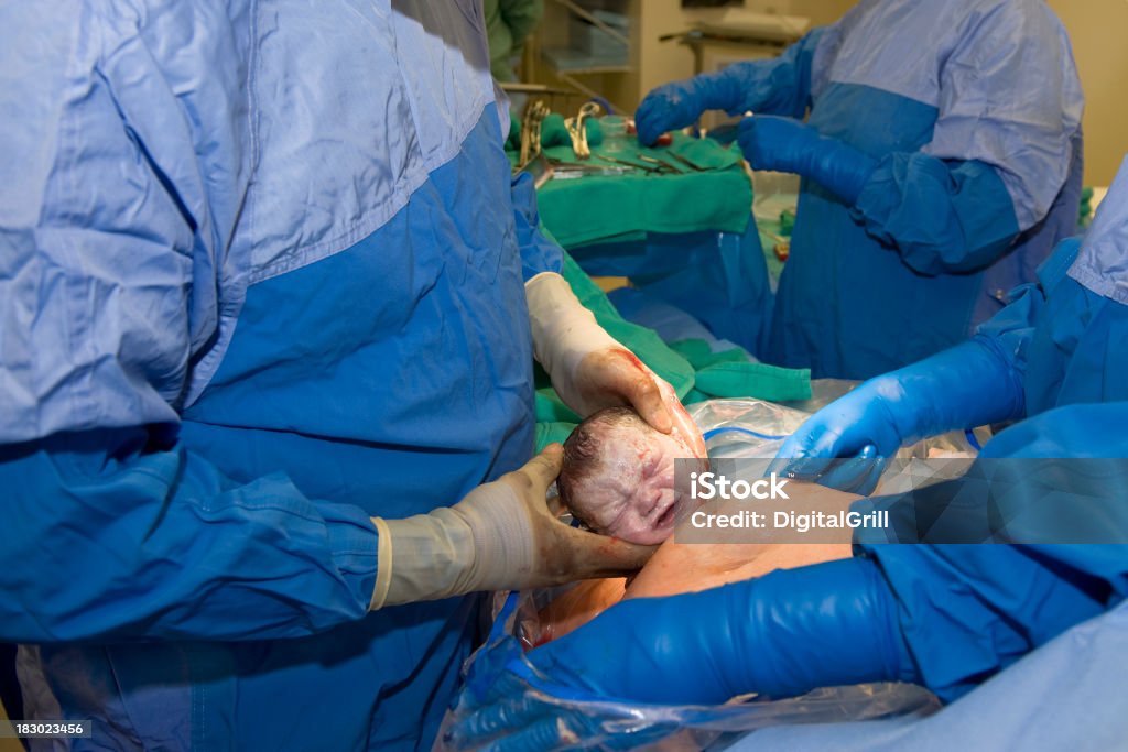 Cesárea nacimiento de cabeza y médico - Foto de stock de Alumbramiento libre de derechos