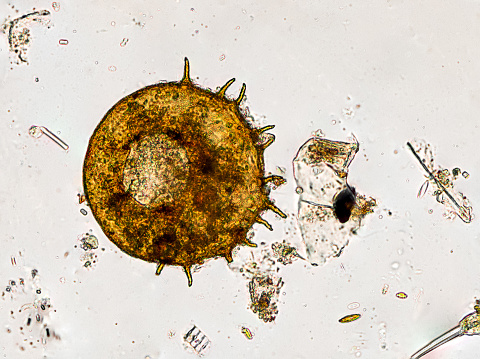 centropyxis aculeata (amoeboid organism) under the microscope - optical microscope x400 magnification