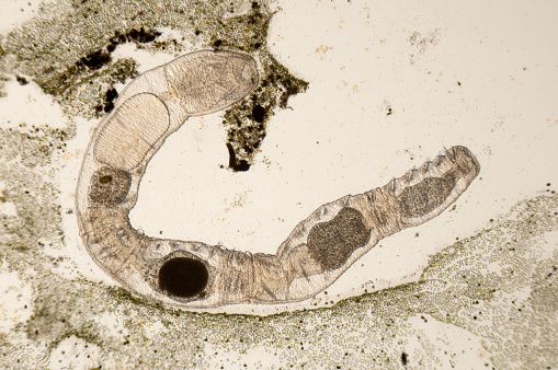 Photomicrograph of segmented worm, Chaetogaster sp. Lives in ponds. Live specimen. Wet mount, 5X objective, transmitted brightfield illumination.