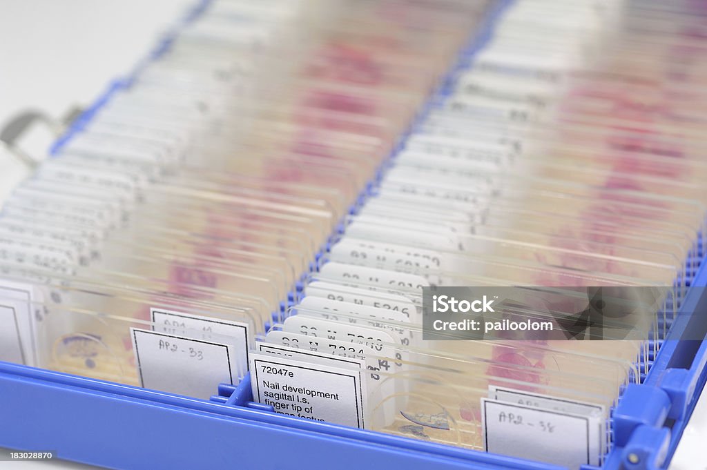 표본 슬라이드 - 로열티 프리 조직학 스톡 사진