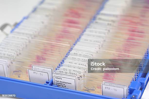 표본 슬라이드 조직학에 대한 스톡 사진 및 기타 이미지 - 조직학, 현미경 슬라이드, 의료 샘플