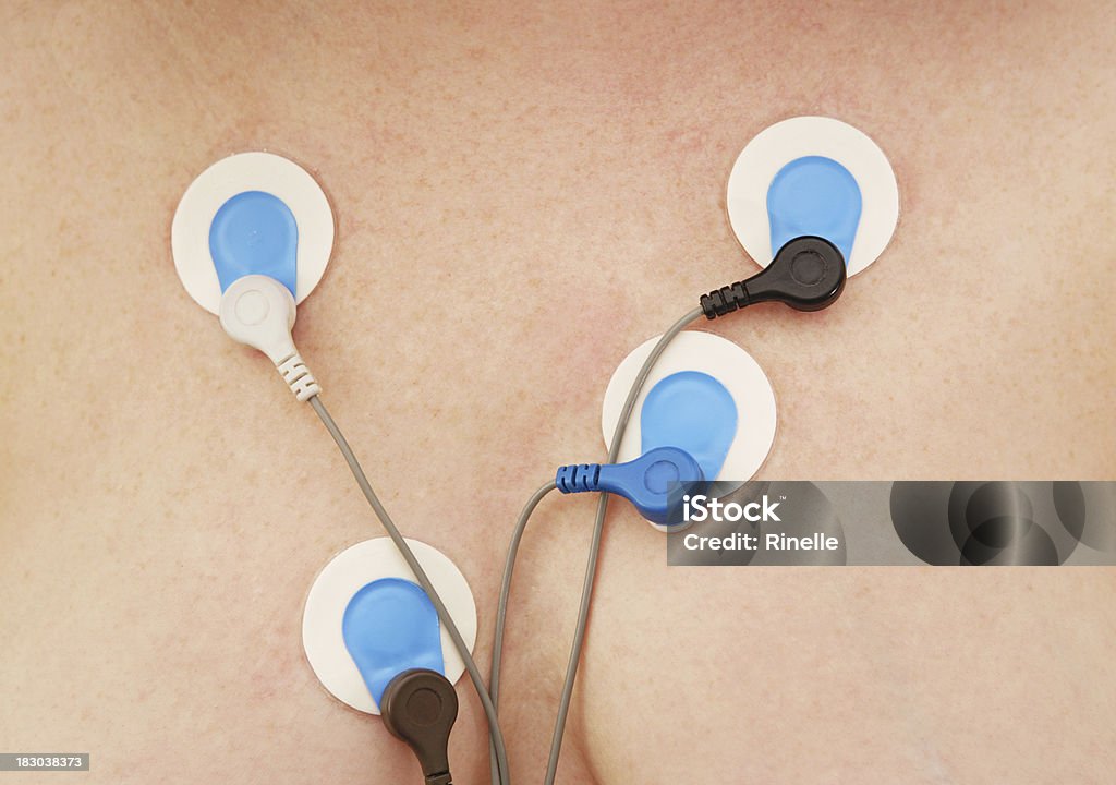 Holter 모니터 센서 - 로열티 프리 전극 스톡 사진