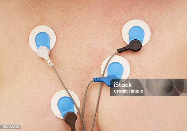 Holter 모니터 센서 전극에 대한 스톡 사진 및 기타 이미지 - 전극, 맥박 추적, 흉부-상체