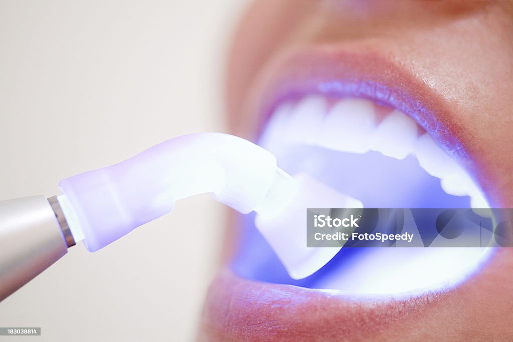 Bei der Zahnarzt - Lizenzfrei Zahnaufhellung Stock-Foto
