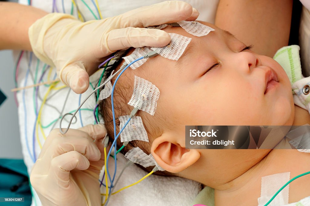 Elettroencefalografia - Foto stock royalty-free di Bebé