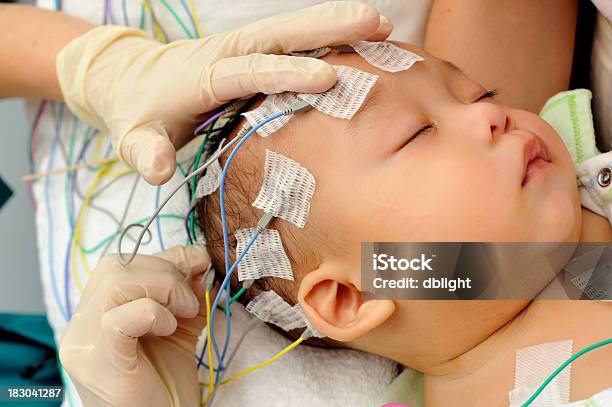 Elettroencefalografia - Fotografie stock e altre immagini di Bebé - Bebé, Sistema nervoso, Elettroencefalogramma