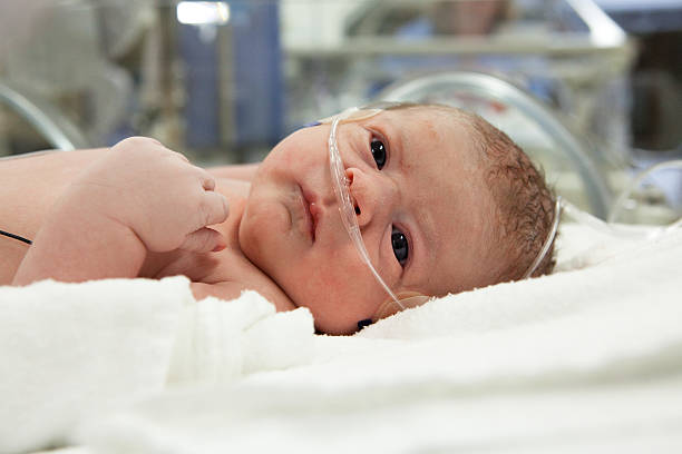 Newborn baby with IV wires and hospital in the background stock photo