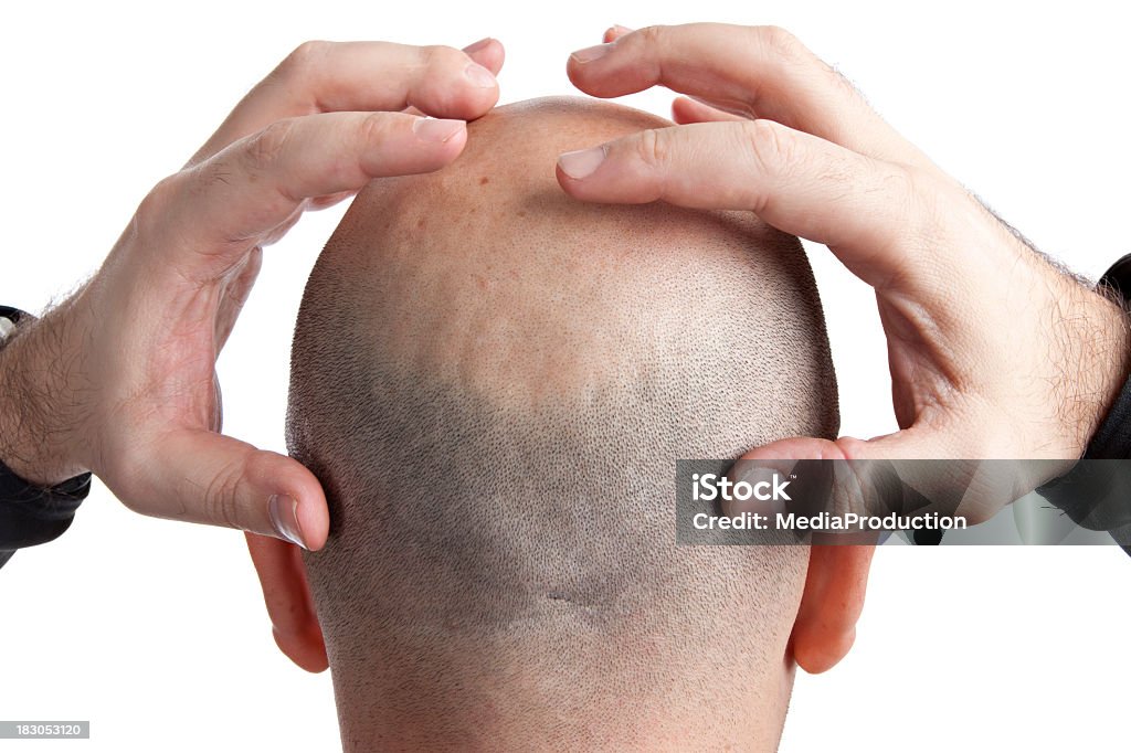 back of a head Back of a balding shaved head with his hands about to grab it,, shocked,, excited,, upset type of an impression Head In Hands Stock Photo