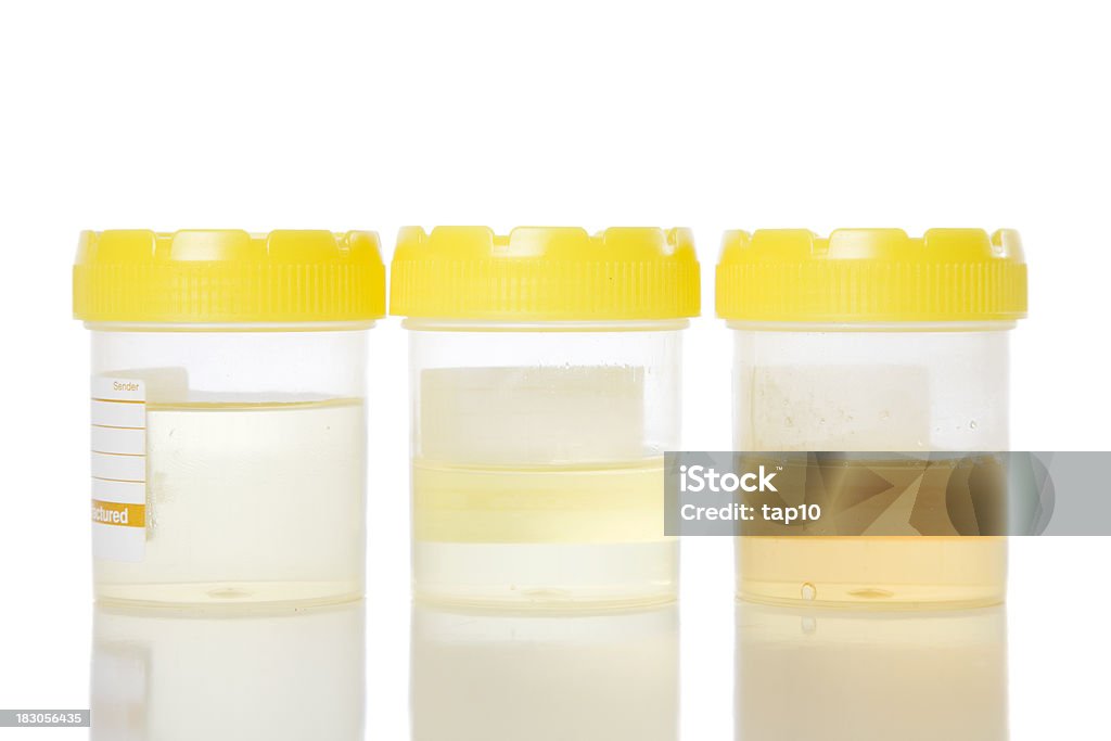 As amostras de urina - Royalty-free Amarelo Foto de stock