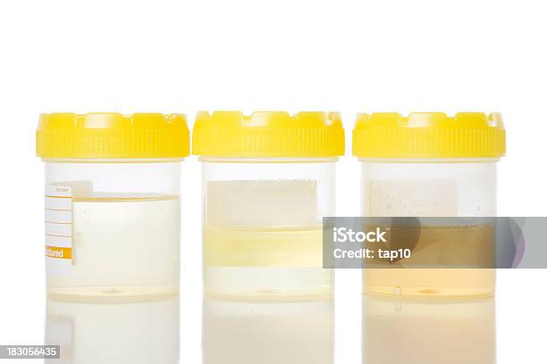 Foto de Amostras De Urina e mais fotos de stock de Amarelo - Amarelo, Amostra de Urina, Espécime Médica