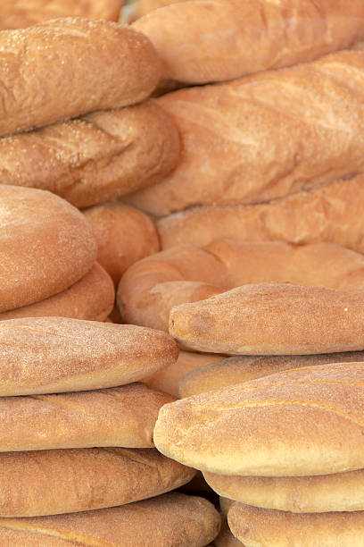 boulangerie méditerranéenne - acute pain photos et images de collection