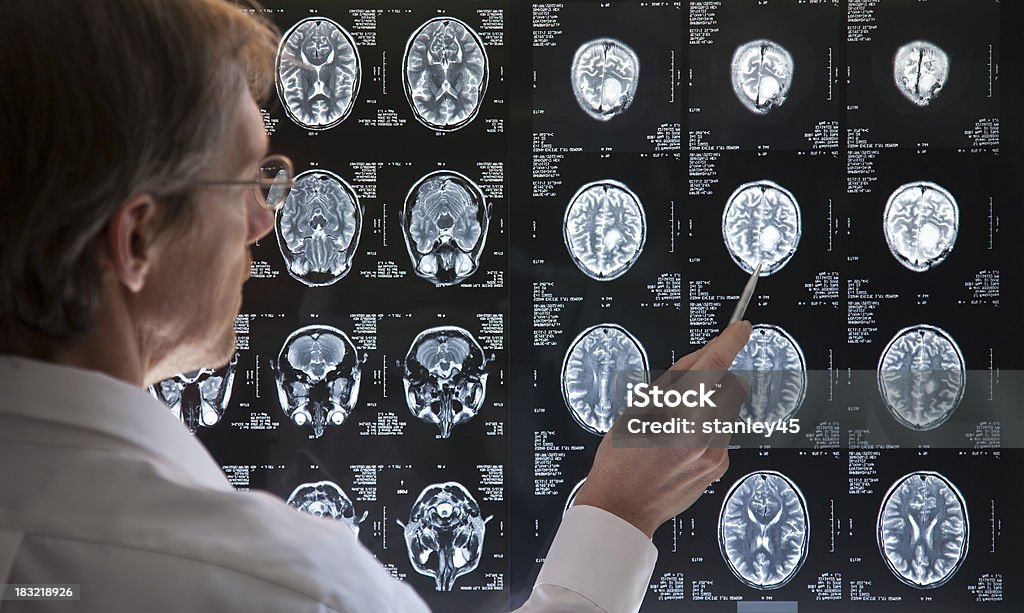 Médecin étudier une Image à résonance magnétique du cerveau - Photo de Cancer libre de droits