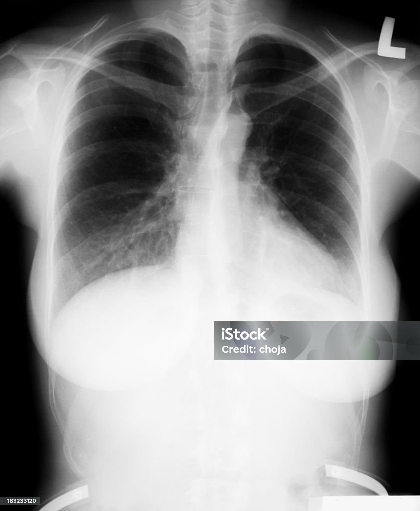 Junge X-ray Techniker zeigt an der Radioaktivität-Schild - Lizenzfrei Atemübung Stock-Foto