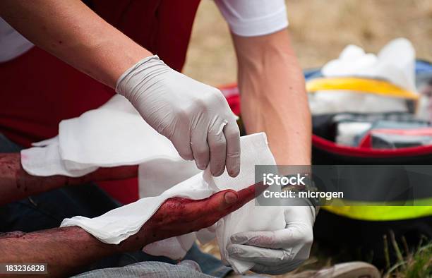 치료는 손 부상 International Red Cross and Red Crescent Movement에 대한 스톡 사진 및 기타 이미지 - International Red Cross and Red Crescent Movement, 개발, 거즈