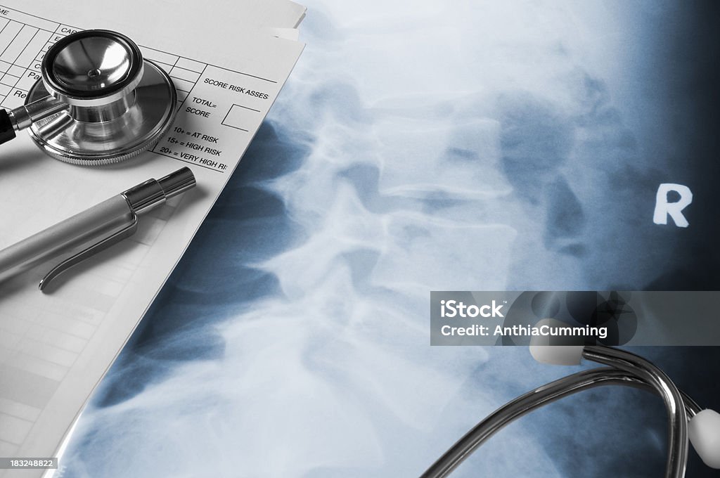 Medical notes and stethoscope on human Xray Doctors Stethoscope on a hospital X-ray with medical notes and pen MRI Scan Stock Photo