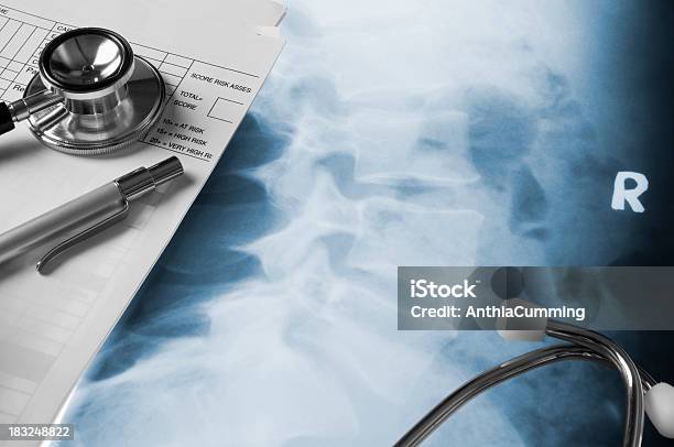 Medical Notes And Stethoscope On Human Xray Stock Photo - Download Image Now - MRI Scan, Anatomy, Biology