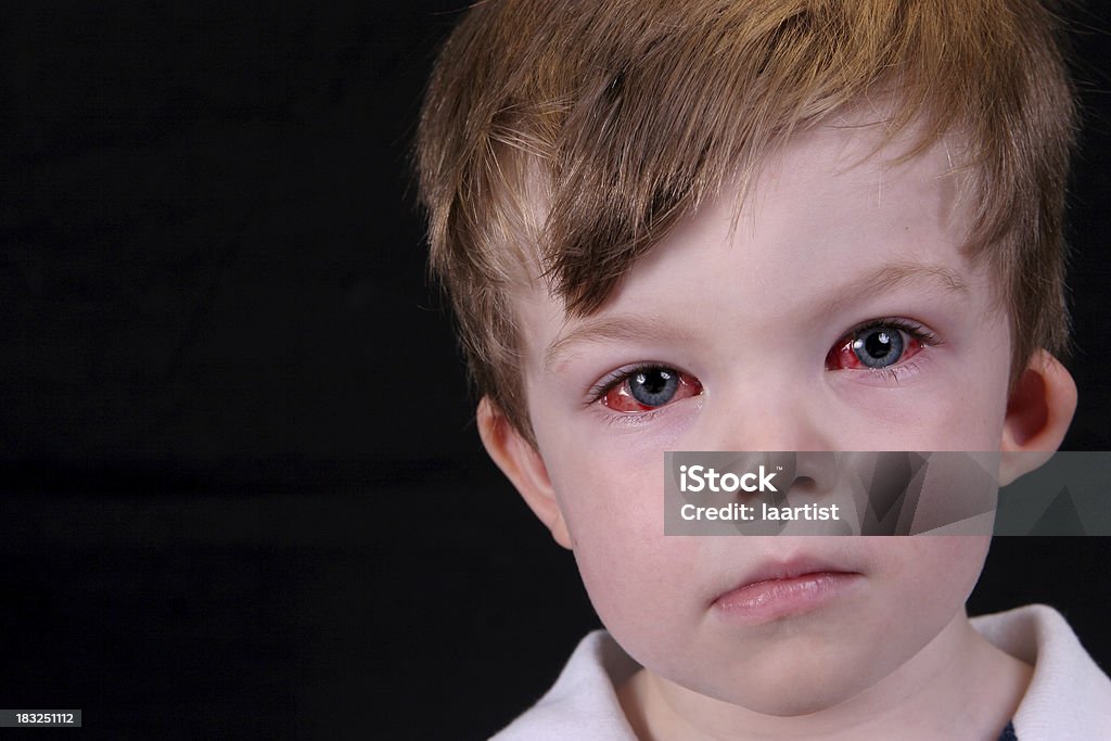 Eye Surgery Recovery 1 Stock Photo - Download Image Now - Child, Sore Eyes, Waiting - iStock Eye Surgery Recovery 1 Stock Photo - Download Image Now - Child, Sore Eyes, Waiting - iStock