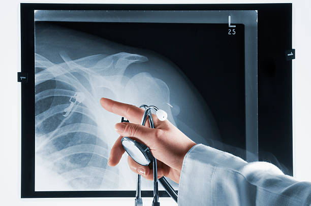 médico señalando en xray con estetoscopio en mano - shoulder bone fotografías e imágenes de stock