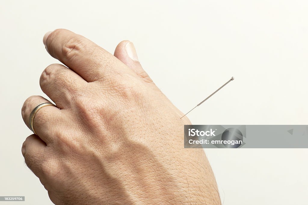 Modèle d'acupuncture - Photo de Acupuncture libre de droits