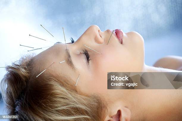 Akupunktura Leczenie - zdjęcia stockowe i więcej obrazów Akupunktura - Akupunktura, Ludzka twarz, Zabieg kosmetyczny