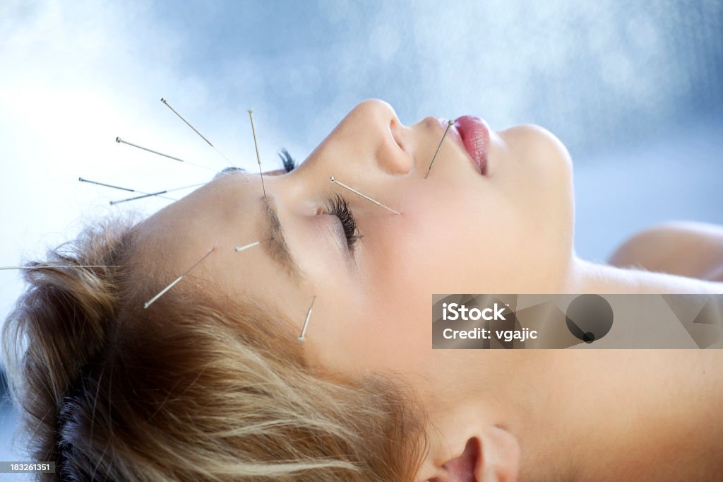 Tratamentos de acupuntura - Foto de stock de Acupuntura royalty-free