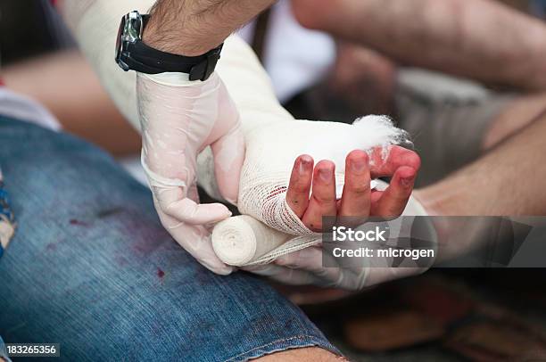 Behandlung Verletzter Hand Stockfoto und mehr Bilder von Erste Hilfe - Erste Hilfe, Verbandskasten, Medikament
