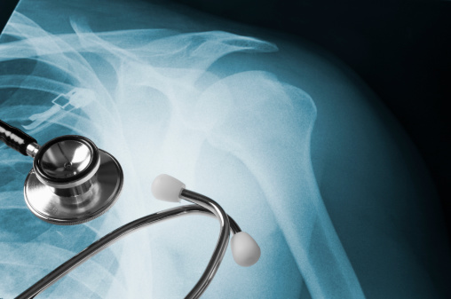 A medical stethoscope is lying on top of an Xray of a human shoulder. The Xray is on a light box showing a dislocated shoulder joint. There is copy space on the right hand side of the image.  The stethoscope is silver with white ear pieces for the doctor to listen through.