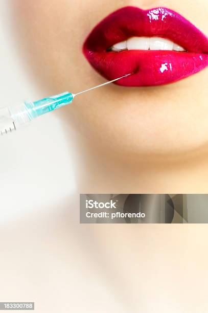 Red Lips 2 Stock Photo - Download Image Now - Syringe, Beauty, Botulinum Toxin Injection