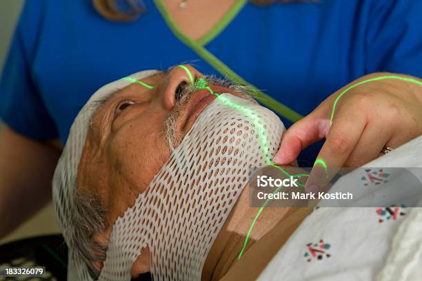 Człowiek Jest Skonfigurowane Dla Radioterapia Głowy I Szyi - zdjęcia stockowe i więcej obrazów Krtań
