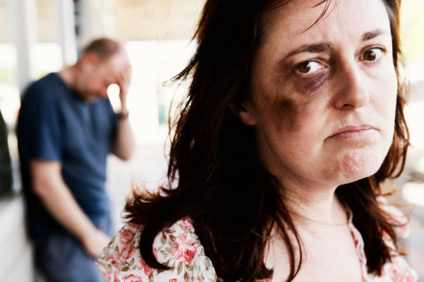 istock Resentful bruised woman with desperate looking man in  background 183332131