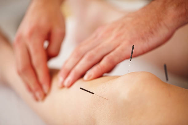 Woman treated with acupuncture Closeup of acupuncture needles with man lightly massaging woman's leg alternative healthcare worker stock pictures, royalty-free photos & images