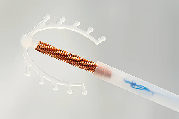 IUD - Demonstration of Efficiency Know stock photo