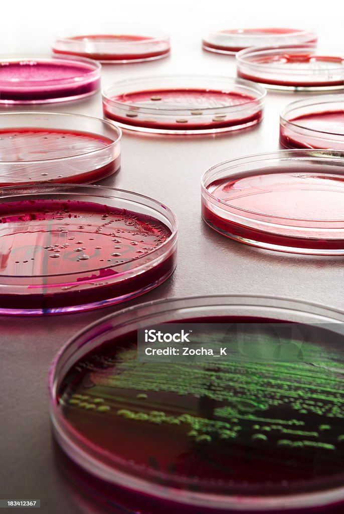 Petri dishes Petri dishes with various bacterial cultures Agar Jelly Stock Photo
