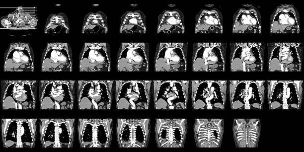 cat scan des thorax und abdomen - angio stock-fotos und bilder