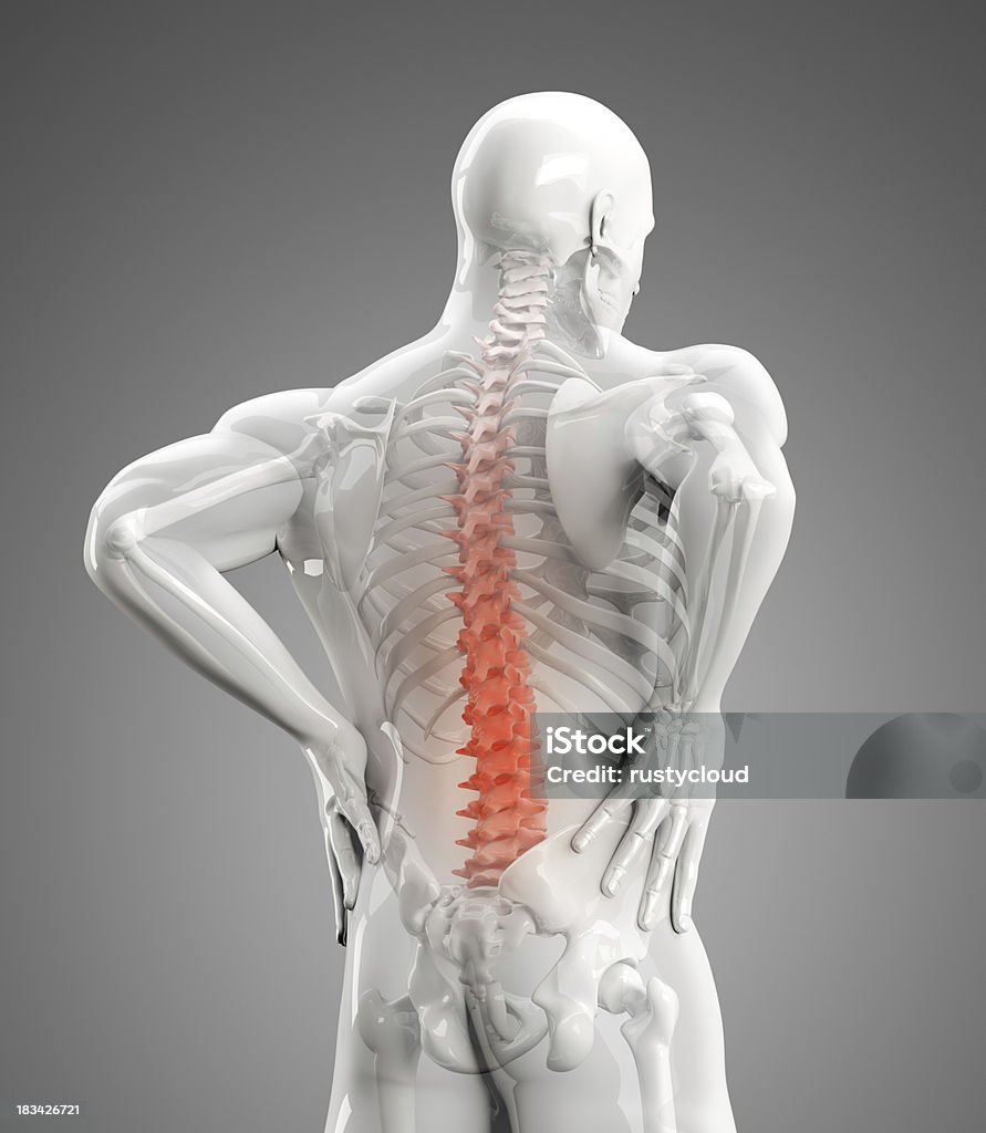 Douleurs dorsales Illustration - Photo de Anatomie libre de droits