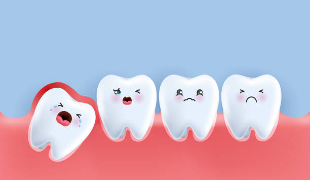 istock Wisdom teeth under the gums cause pain in the mouth. Impacted wisdom tooth character pushing adjacent teeth causing inflammation, toothache, gum pain. vector design. 1834425613