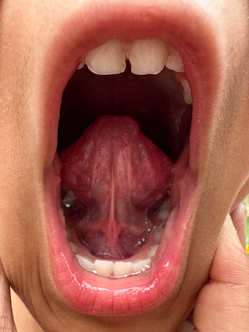 Stock photo showing a close-up view of the open mouth of young child showing teeth due to losing her baby teeth and tongue.