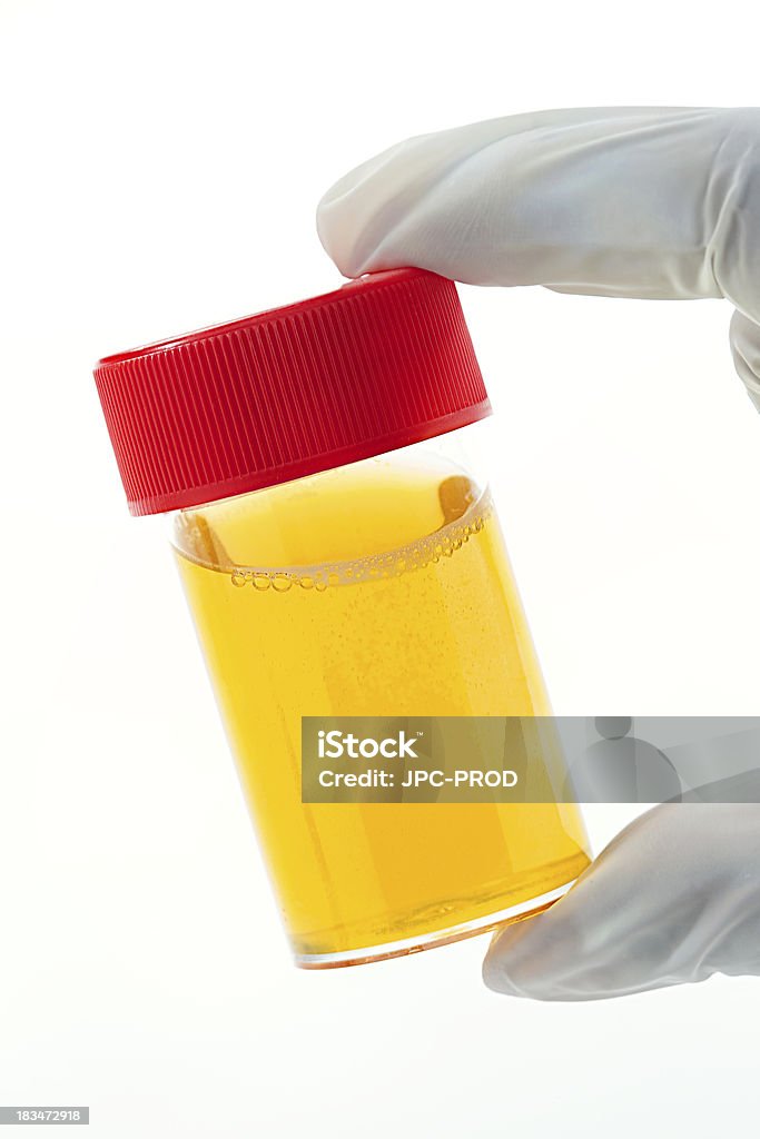 Urina-amostra-Medical análise - Foto de stock de Amostra de Urina royalty-free
