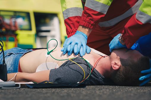 Hands of paramedic and doctor during resuscitation on road against ambulance car. Patient and team of emergency medical service. Themes rescue, urgency and health care.